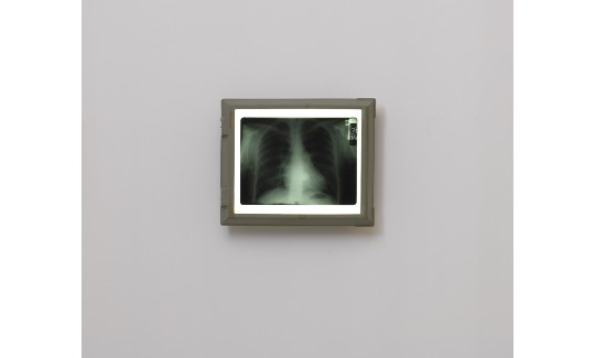 גדעון גכטמן, צילום רנטגן