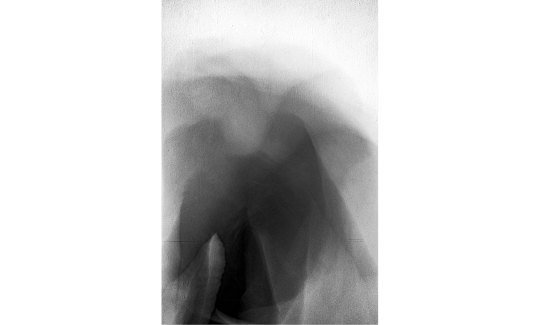 לילו אינשטייןצילום: ג'ני